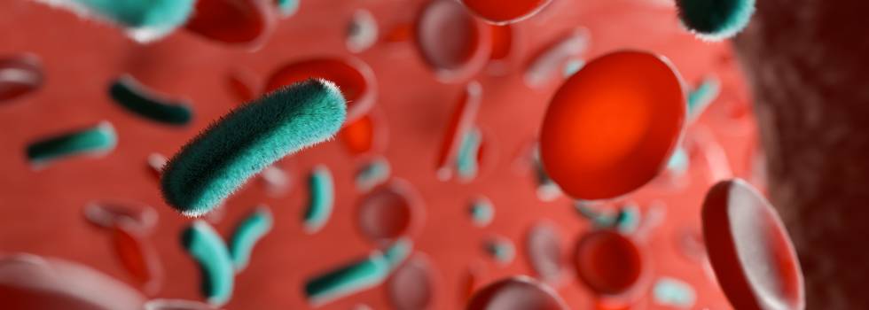 La sepsis y el impacto de la resistencia a los antibióticos